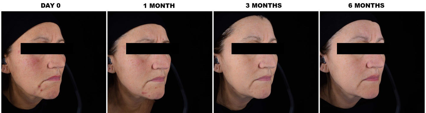 AGE PROTEOM SÉRUM AVANCÉ